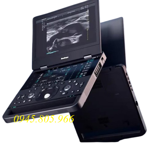 Bảng giá máy siêu âm xách tay SonoScape, Mindray, Chison, GE, Dawei tại Y Tế Việt Nhật